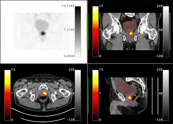 Orthogonal views are shown for a 65 year old male