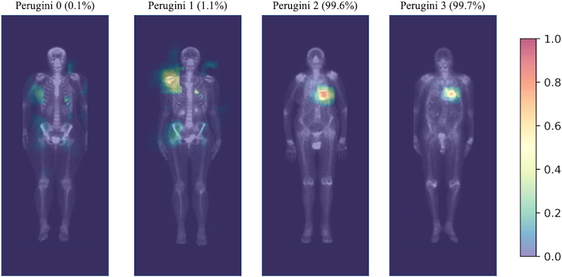 Highlighted areas contribute the most to the positive prediction in the convolution layers